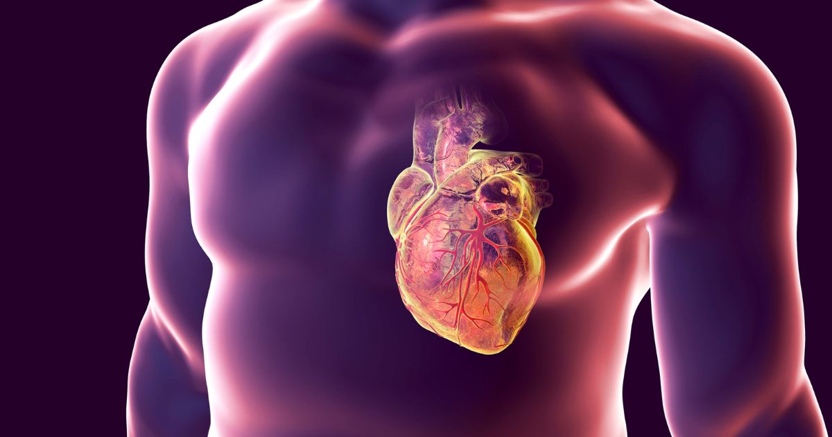 Ισχαιμική Μυοκαρδιοπάθεια