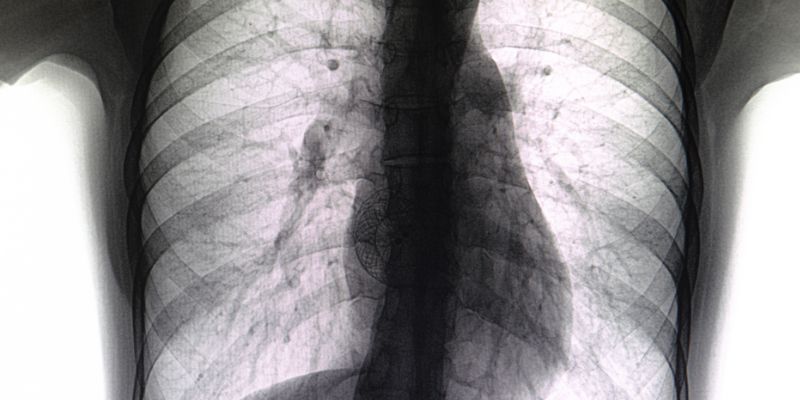 μεσοκολπική επικοινωνία